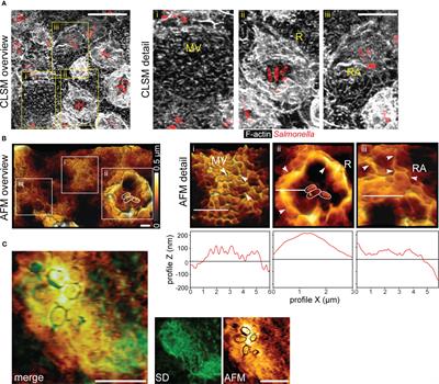 Manipulation of microvillar proteins during Salmonella enterica invasion results in brush border effacement and actin remodeling